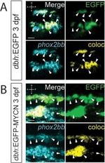 Rabbit IgG (H+L) Cross-Adsorbed Secondary Antibody in Immunocytochemistry (ICC/IF)