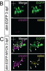 Rabbit IgG (H+L) Cross-Adsorbed Secondary Antibody in Immunocytochemistry (ICC/IF)