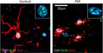 Rabbit IgG (H+L) Cross-Adsorbed Secondary Antibody in Immunocytochemistry (ICC/IF)