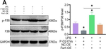 Rabbit IgG (H+L) Secondary Antibody in Western Blot (WB)