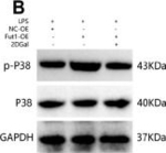 Rabbit IgG (H+L) Secondary Antibody in Western Blot (WB)