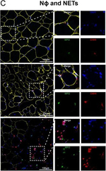 Mouse IgG (H+L) Highly Cross-Adsorbed Secondary Antibody in Immunohistochemistry (Frozen) (IHC (F))
