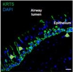 Rabbit IgG (H+L) Cross-Adsorbed Secondary Antibody in Immunohistochemistry (Frozen) (IHC (F))