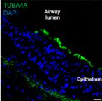Rabbit IgG (H+L) Cross-Adsorbed Secondary Antibody in Immunohistochemistry (Frozen) (IHC (F))