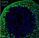 Rabbit IgG (H+L) Cross-Adsorbed Secondary Antibody in Immunocytochemistry (ICC/IF)