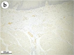 Mouse IgG (H+L) Cross-Adsorbed Secondary Antibody in Immunohistochemistry (Paraffin) (IHC (P))