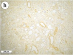 Mouse IgG (H+L) Cross-Adsorbed Secondary Antibody in Immunohistochemistry (Paraffin) (IHC (P))