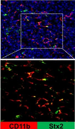 Mouse IgG (H+L) Highly Cross-Adsorbed Secondary Antibody in Immunocytochemistry (ICC/IF)