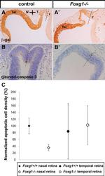 beta Galactosidase Antibody in Immunohistochemistry (IHC)