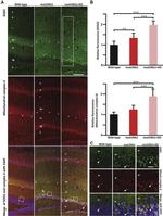 SDHA Antibody in Immunohistochemistry (Paraffin) (IHC (P))