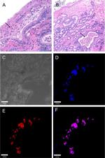 Pseudomonas Antibody in Immunohistochemistry, Immunohistochemistry (Paraffin) (IHC, IHC (P))