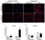 Versican V0, V1 Neo Antibody in Immunohistochemistry (IHC)