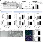 UCP1 Antibody in Immunohistochemistry (Paraffin), Immunocytochemistry (IHC (P), ICC/IF)