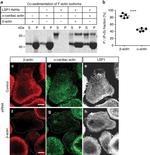 alpha-Cardiac Actin Antibody in Immunohistochemistry, Immunocytochemistry (IHC, ICC/IF)