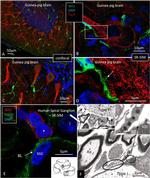 IBA1 Antibody in Immunohistochemistry, Immunohistochemistry (Frozen) (IHC, IHC (F))