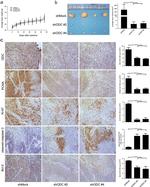 Ki-67 Antibody in Immunohistochemistry (IHC)