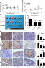 Ki-67 Antibody in Immunohistochemistry (IHC)