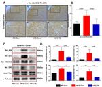 Phospho-Tau (Ser202, Thr205) Antibody in Immunohistochemistry (IHC)