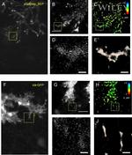 GFP Antibody in Immunohistochemistry (IHC)
