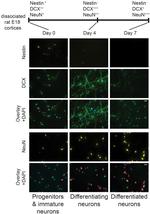 Nestin Antibody in Immunohistochemistry, Immunocytochemistry (IHC, ICC/IF)
