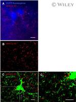 GFP Antibody in Immunocytochemistry (ICC/IF)