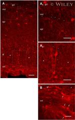 GFP Antibody in Immunocytochemistry (ICC/IF)