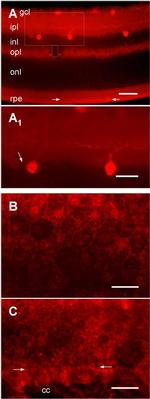 GFP Antibody in Immunocytochemistry (ICC/IF)