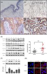 DIPA Antibody in Immunocytochemistry (ICC/IF)