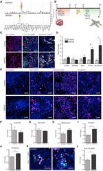 Ki-67 Antibody in Immunocytochemistry (ICC/IF)
