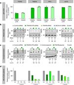 Acid Phosphatase 2 Antibody in Western Blot (WB)