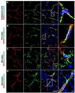 GFAP Antibody in Immunocytochemistry (ICC/IF)