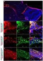GFAP Antibody in Immunocytochemistry (ICC/IF)