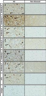 Phospho-Tau (Ser202, Thr205) Antibody in Immunohistochemistry (IHC)