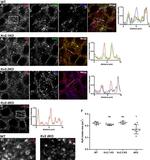RyR1 Antibody in Immunohistochemistry (IHC)