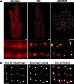 Ryanodine Receptor Antibody in Immunocytochemistry (ICC/IF)