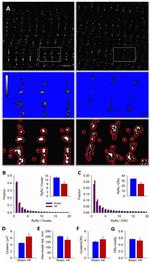 Ryanodine Receptor Antibody in Immunocytochemistry (ICC/IF)