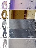 Ki-67 Antibody in Immunohistochemistry (IHC)