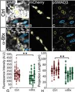 mCherry Antibody in Immunohistochemistry, Immunocytochemistry (IHC, ICC/IF)