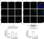 HuC/HuD Antibody in Immunohistochemistry (IHC)