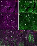 MTCO2 Antibody in Immunohistochemistry (IHC)