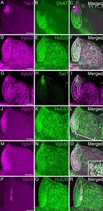 HuC/HuD Antibody in Immunohistochemistry (IHC)