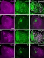 HuC/HuD Antibody in Immunohistochemistry (IHC)