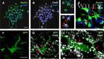 Connexin 43 Antibody in Immunohistochemistry, Immunocytochemistry (IHC, ICC/IF)