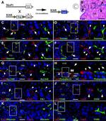 CD166 (ALCAM) Antibody in Immunohistochemistry (IHC)