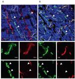 ZO-1 Antibody in Immunohistochemistry (IHC)