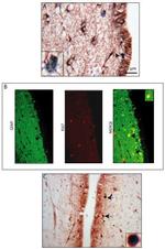 GFAP Antibody in Immunocytochemistry (ICC/IF)