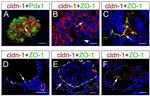 Claudin 1 Antibody in Immunohistochemistry (IHC)