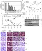 Hepatitis C Virus Core Antigen Antibody in Western Blot (WB)