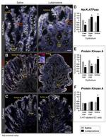ATP1A1 Antibody in Immunohistochemistry (IHC)