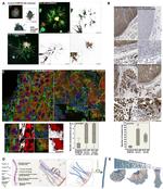 TagRFP Antibody in Immunohistochemistry (IHC)